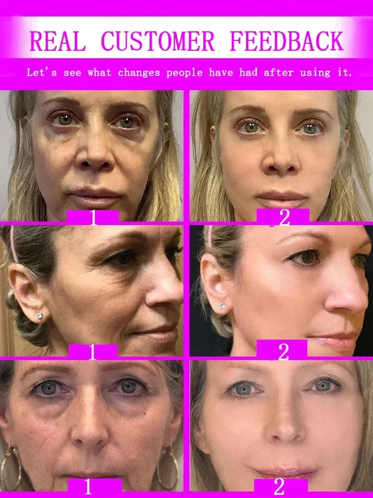 Instant Wrinkle Relief: Korea Cosmetic Anti-Aging Serum-4